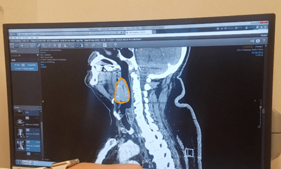 29527127_10213758943861497_772269377_o