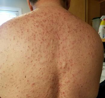 32724779_10214136397017590_1545559864254660608_n