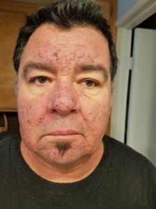 33995385_10214228807687799_2801976826426032128_n